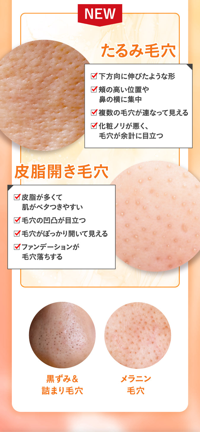 たるみ毛穴/皮脂開き毛穴