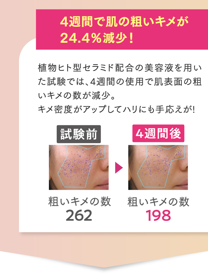 4週間で肌の粗いキメが24.4％減少！！