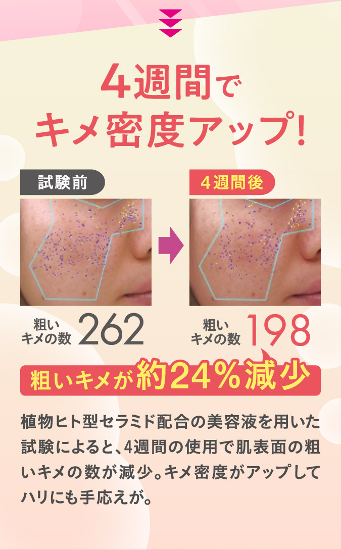 4週間でキメ密度アップ！