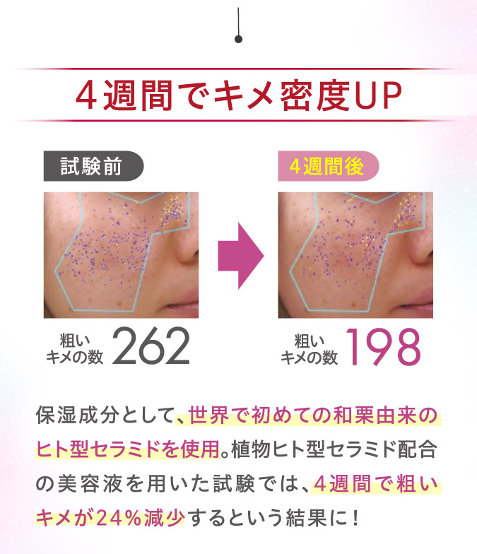 4週間でキメ密度UP