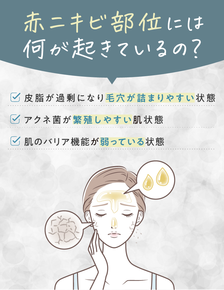 赤ニキビ部位には何が起きているの？