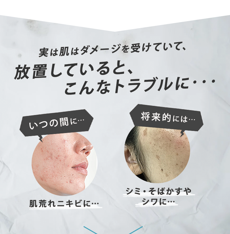 実は肌はダメージを受けていて、放置していると、こんなトラブルに・・・　いつの間に…肌荒れニキビに…　将来的には…シミ・そばかすやシワに…